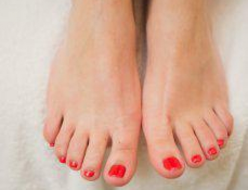 Ingrown Toenails